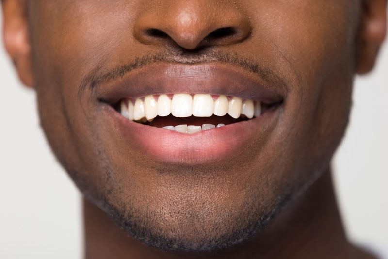 Best Dentist Near Me in Santa Monica, CA